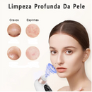 Removedor de Cravos a Vácuo Elétrico