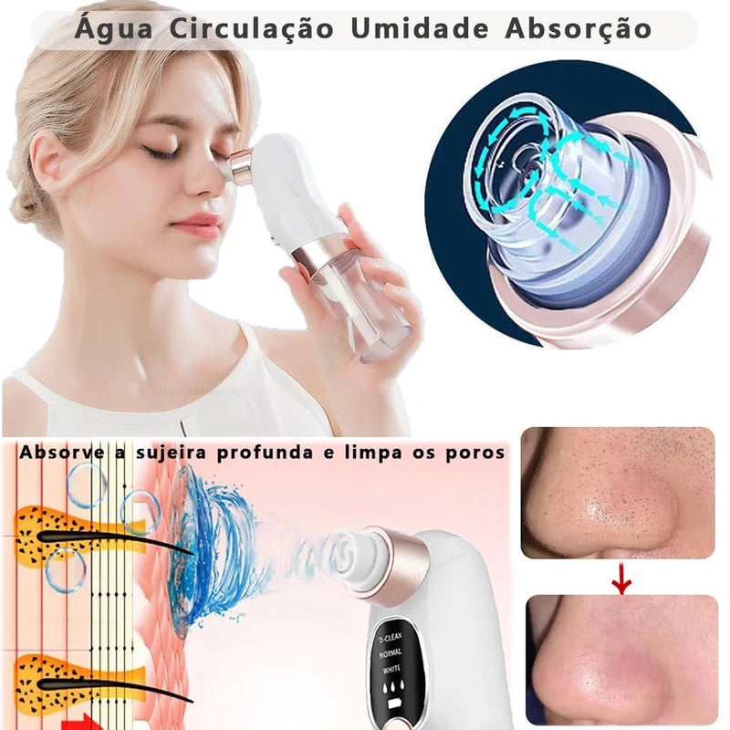 Removedor de Cravos a Vácuo Elétrico